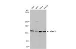 HDAC4 Antibody in Western Blot (WB)