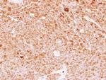 DMP4 Antibody in Immunohistochemistry (Paraffin) (IHC (P))