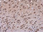 SAP102 Antibody in Immunohistochemistry (Paraffin) (IHC (P))