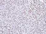 SMC1 Antibody in Immunohistochemistry (Paraffin) (IHC (P))