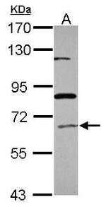 ACOX1 Antibody in Western Blot (WB)