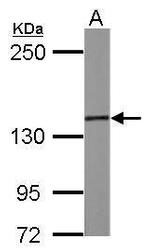 SMC3 Antibody in Western Blot (WB)