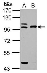 TFR2 Antibody in Western Blot (WB)