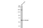 VPS33B Antibody in Western Blot (WB)