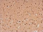 gamma Synuclein Antibody in Immunohistochemistry (Paraffin) (IHC (P))