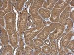 FRAT1 Antibody in Immunohistochemistry (Paraffin) (IHC (P))