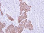 FRAT1 Antibody in Immunohistochemistry (Paraffin) (IHC (P))