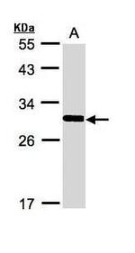 FRAT1 Antibody in Western Blot (WB)