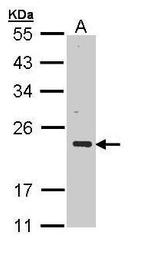 CSRP3 Antibody in Western Blot (WB)