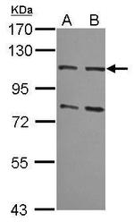 MSH2 Antibody in Western Blot (WB)