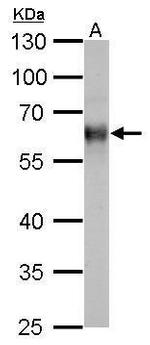 TrxR1 Antibody in Western Blot (WB)