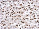 SP1 Antibody in Immunohistochemistry (Paraffin) (IHC (P))