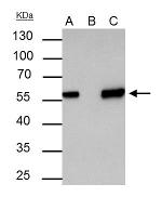 AKT1 Antibody in Immunoprecipitation (IP)