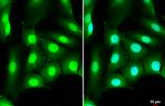 DDX3 Antibody in Immunocytochemistry (ICC/IF)