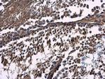 CAB39 Antibody in Immunohistochemistry (Paraffin) (IHC (P))