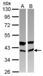 CAB39 Antibody in Western Blot (WB)