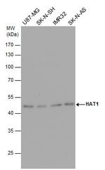 HAT1 Antibody in Western Blot (WB)