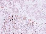 VCAM-1 Antibody in Immunohistochemistry (Paraffin) (IHC (P))