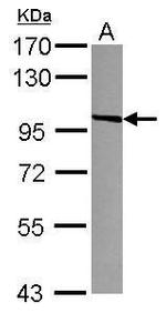 VCAM-1 Antibody in Western Blot (WB)