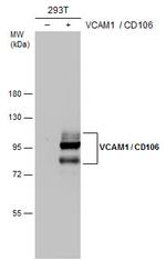 VCAM-1 Antibody in Western Blot (WB)