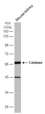 Catalase Antibody in Western Blot (WB)