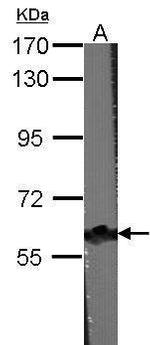 CARD9 Antibody in Western Blot (WB)