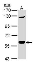 CARD9 Antibody in Western Blot (WB)