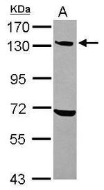 UBE4A Antibody in Western Blot (WB)