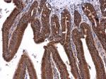 ATP5J Antibody in Immunohistochemistry (Paraffin) (IHC (P))