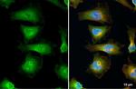 eIF5A Antibody in Immunocytochemistry (ICC/IF)