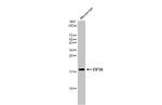 eIF5A Antibody in Western Blot (WB)