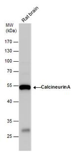 Calcineurin A Antibody in Western Blot (WB)