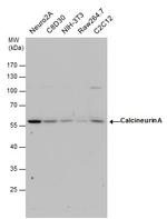 Calcineurin A Antibody in Western Blot (WB)