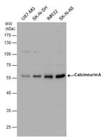 Calcineurin A Antibody in Western Blot (WB)