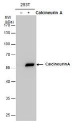 Calcineurin A Antibody in Western Blot (WB)