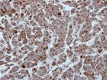 HSP701L Antibody in Immunohistochemistry (Paraffin) (IHC (P))