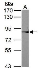 RSK2 Antibody in Western Blot (WB)