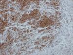 RSK1 Antibody in Immunohistochemistry (Paraffin) (IHC (P))