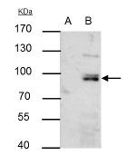 PI3K p85 alpha Antibody in Immunoprecipitation (IP)