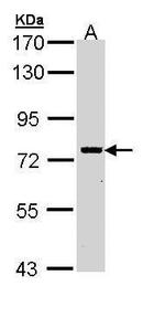 RIP1 Antibody in Western Blot (WB)