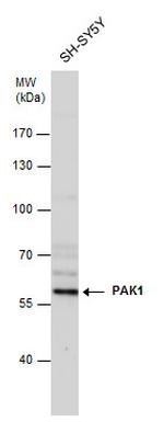 PAK1 Antibody in Western Blot (WB)