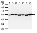 TID1 Antibody in Western Blot (WB)