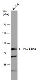 PKC alpha Antibody in Western Blot (WB)