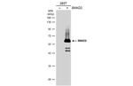 SMAD2 Antibody in Western Blot (WB)