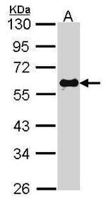 SMAD2 Antibody in Western Blot (WB)