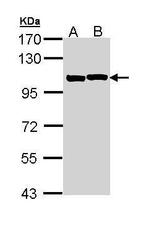 alpha Actinin 2 Antibody in Western Blot (WB)