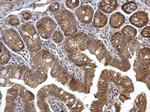 alpha Catenin Antibody in Immunohistochemistry (Paraffin) (IHC (P))