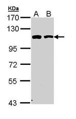 alpha Catenin Antibody in Western Blot (WB)