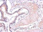 PLCG2 Antibody in Immunohistochemistry (Paraffin) (IHC (P))