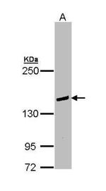 PLCG2 Antibody in Western Blot (WB)